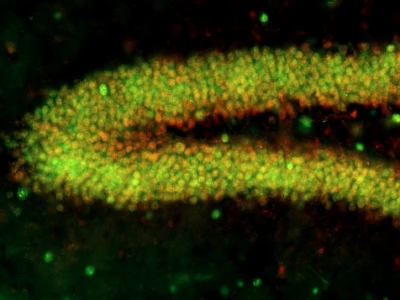 subgroup-image